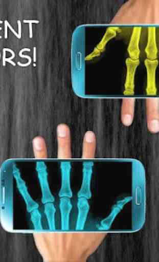X-Ray Scanner (Streich - Prank) 2