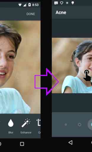Face Acne Remover Photo Editor App 2