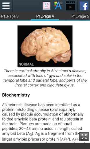 Alzheimer's Info 2