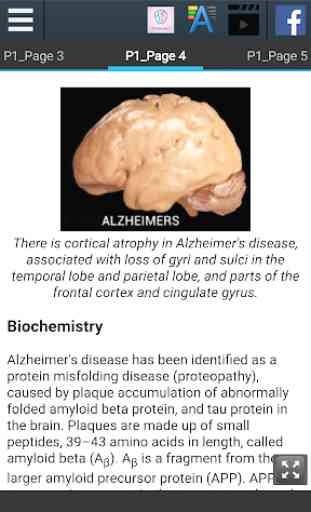 Alzheimer's Info 3
