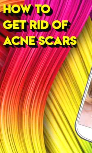 HOW TO GET RID OF ACNE SCARS 1
