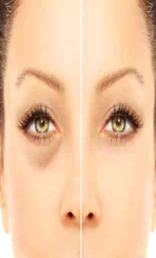 how to remove dark circles  (Guide) 1
