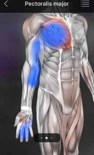 Muskel Triggerpunkte 4